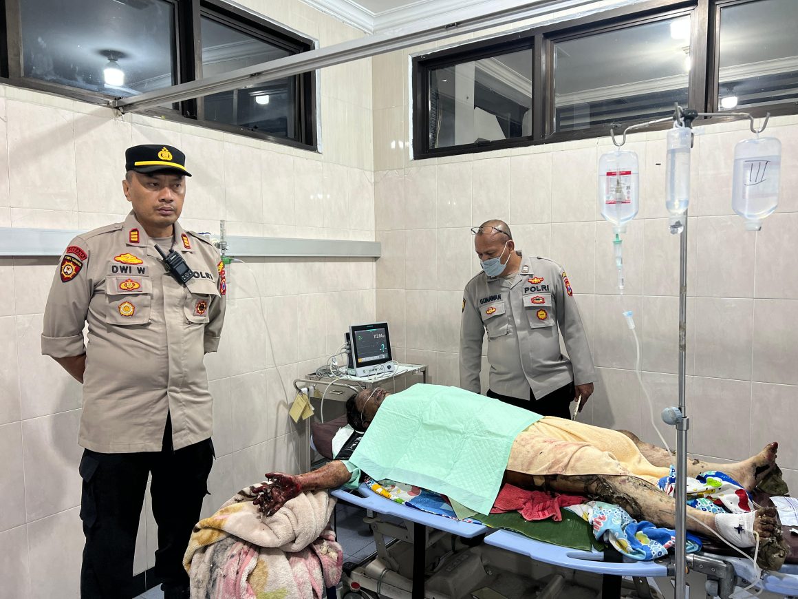 Dipicu Cekcok Rumah Tangga, Suami  di Banyuwangi Bakar Istri Hingga Meninggal